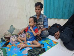 Anak 6 Tahun di Lebak Alami Gizi Buruk, Gubernur Banten Instruksikan Baznas Berikan Bantuan