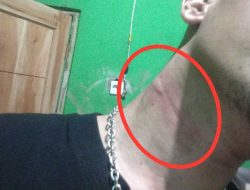 Aldi Renaldi Mengutuk Keras Kelalaian Pengusaha WiFi: Kabel Menjuntai Rendah Lukaikan Pengguna Jalan di Cipedang